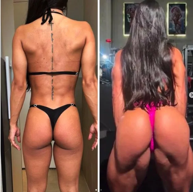 Evolução em destaque — antes e depois, costas