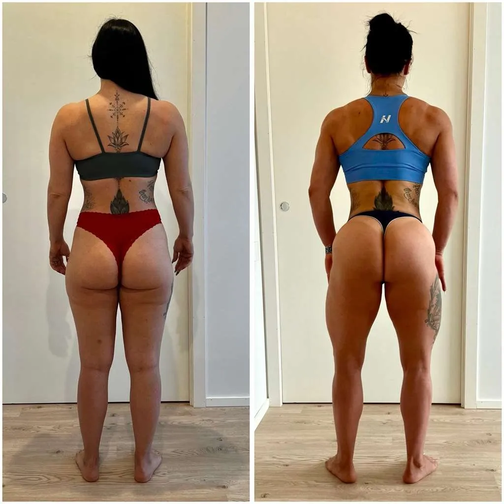 Evolução de aluna GNTEAM — simetria de costas, antes e depois